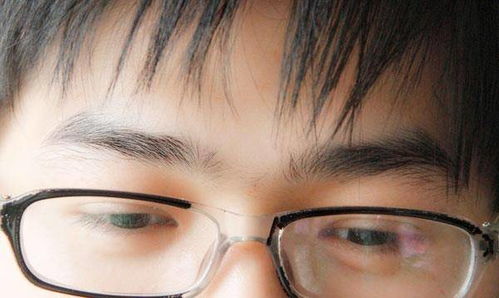 戴眼镜会加重度数？高度近视者的生活禁区与护眼指南